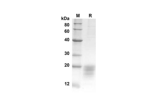 SDS-PAGE analysis of Human IL5 proteins, 2 μg/lane of Recombinant Human IL5 proteins was resolved with an SDS-PAGE under reducing conditions, showing bands at 14.6 kDa.