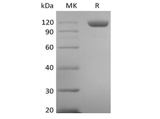 Recombinant Human Tie-2 (C-6His) - ABMIUM