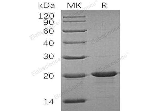 Recombinant Human Interleukin-33/IL-33 Protein (His Tag) - ABMIUM