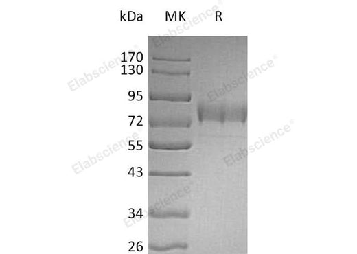 Recombinant Human SIGLEC3/CD33 Protein (Fc & His Tag) - ABMIUM