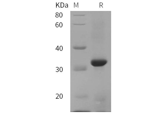 SDS-PAGE analysis of Cynomolgus macaques CD38/ADPRC1 proteins, 2 μg/lane of Recombinant Cynomolgus macaques CD38/ADPRC1 proteins was resolved with SDS-PAGE under reducing conditions, showing bands at 32 kDa.