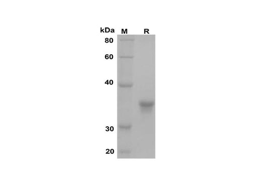 SDS-PAGE analysis of Mouse IL-33 proteins, 2 μg/lane of Recombinant Mouse IL-33 proteins was resolved with SDS-PAGE under reducing conditions, showing bands at 37 kDa.