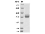 Recombinant SARS-CoV-2 Spike RBD(A352S)(His Tag) - ABMIUM