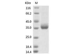 Recombinant SARS-CoV-2 Spike RBD(A352S)(His Tag) - ABMIUM
