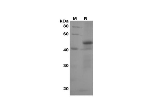 SDS-PAGE analysis of Human AK2/Adenylate kinase 2 proteins, 2 μg/lane of Recombinant Human AK2/Adenylate kinase 2 proteins was resolved with SDS-PAGE under reducing conditions, showing bands at 52 kDa.