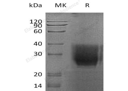 Recombinant Human CD147/Basigin Protein (His Tag) - ABMIUM