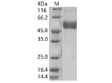 Recombinant WNV (lineage 1, strain NY99) NS1 Protein (His Tag) - ABMIUM