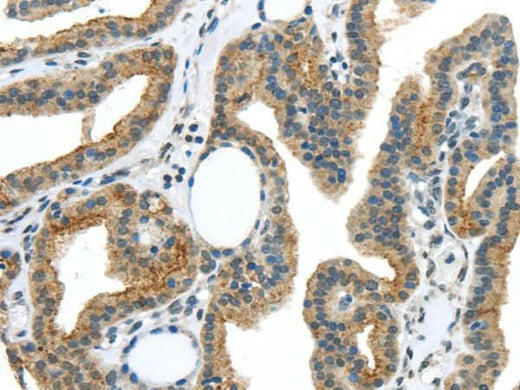 Anti-Human/Mouse/Rat VAMP2 Antibody - ABMIUM
