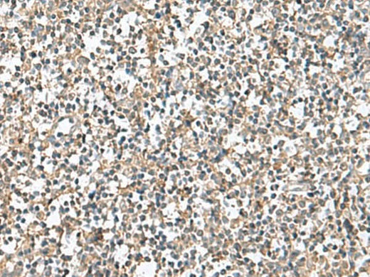 Immunohistochemistry of paraffin-embedded Human tonsil tissue using PTPRS Polyclonal Antibody at dilution of 1:110(×200)