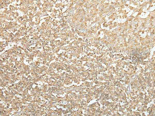 Immunohistochemistry of paraffin-embedded Human tonsil tissue using SPIC Polyclonal Antibody at dilution of 1:55(×200)