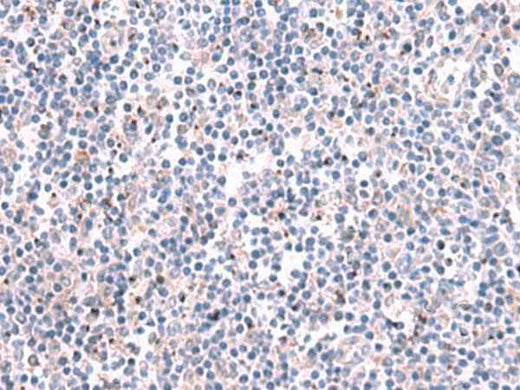 Immunohistochemistry of paraffin-embedded Human tonsil tissue using KCNK10 Polyclonal Antibody at dilution of 1:35(×200)
