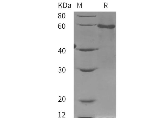 SDS-PAGE analysis of Human AMH proteins, 2 μg/lane of Recombinant Human AMH proteins was resolved with SDS-PAGE under reducing conditions, showing bands at 60 kDa.
