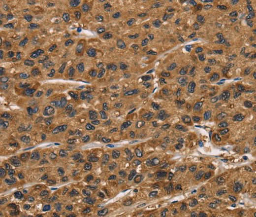 Anti-Human/Mouse/Rat ATP7A Antibody - ABMIUM
