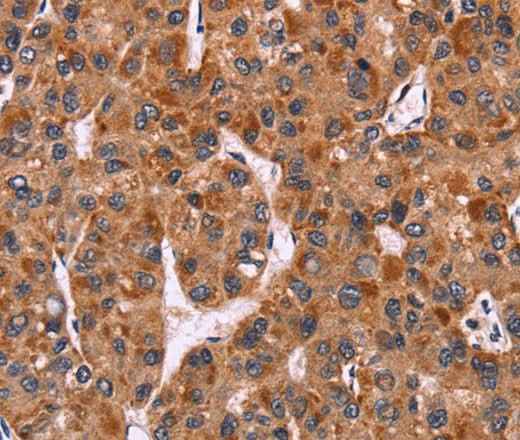 Anti-Human/Mouse CARD11 Antibody - ABMIUM