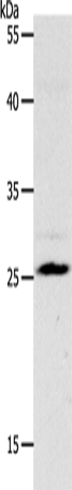 Anti-Human/Mouse NQO2 Antibody - ABMIUM