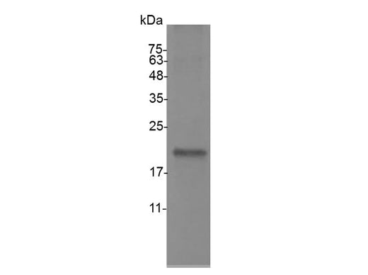Recombinant Mouse IL-19 protein(His Tag) - ABMIUM