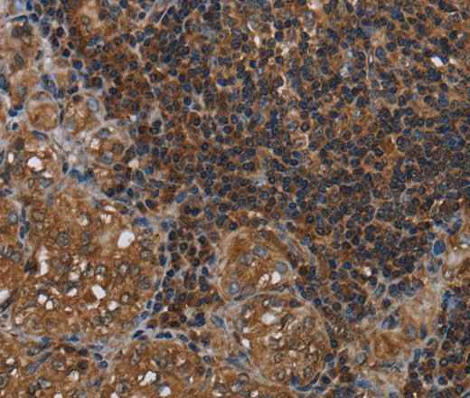 Anti-Human/Mouse/Rat HOMER2 Antibody