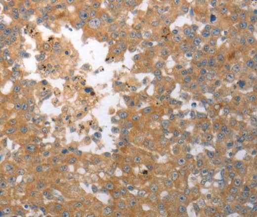 Anti-Human/Mouse/Rat SHH Antibody