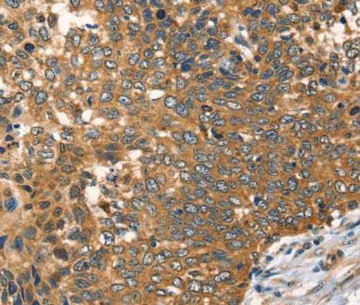 Anti-Human/Mouse AGO1 Antibody - ABMIUM