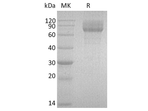 Recombinant Human IL-22BP/IL-22RA2 Protein (Fc Tag) - ABMIUM