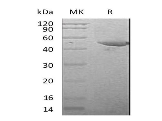 Recombinant Mouse Serpin E1/PAI-1 Protein (His Tag) - ABMIUM