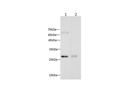 Anti-Mouse/Rat CXCL16 Antibody - ABMIUM