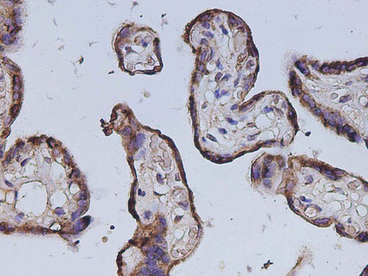 Anti-Human Gh1 Antibody