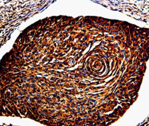 Anti-Human/Mouse ANXA7 Antibody