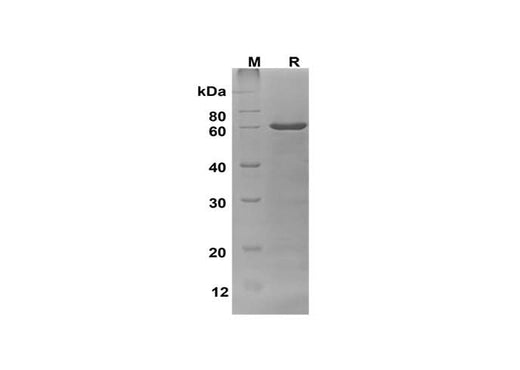 SDS-PAGE analysis of Human OCLN proteins, 2 μg/lane of Recombinant Human OCLN proteins was resolved with SDS-PAGE under reducing conditions, showing bands at 58 kDa.