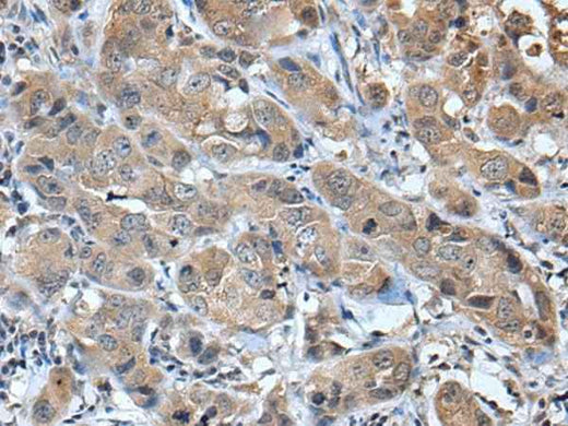 Anti-Human CXCL5 Antibody