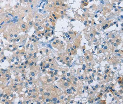 Anti-Human BTN2A2 Antibody