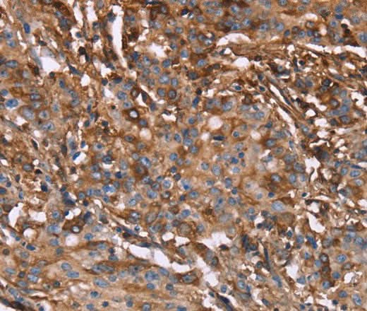 Anti-Human HP Antibody - ABMIUM
