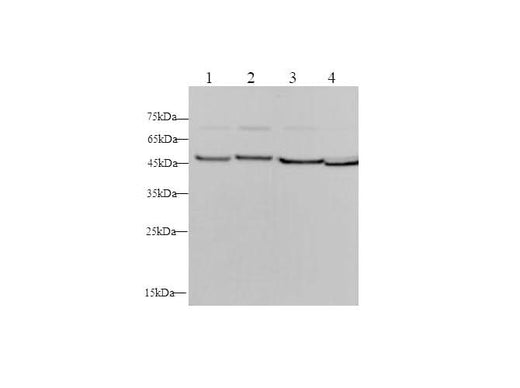Anti-Human/Mouse/Rat ENO2 Antibody - ABMIUM