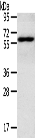 Anti-Human RORA Antibody - ABMIUM