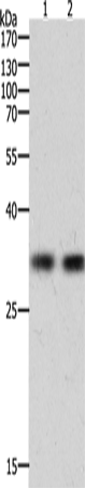 Anti-Human HAVCR1 Antibody - ABMIUM