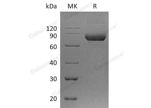 Recombinant Human IL5RA/IL-5 Rα Protein (Fc Tag) - ABMIUM