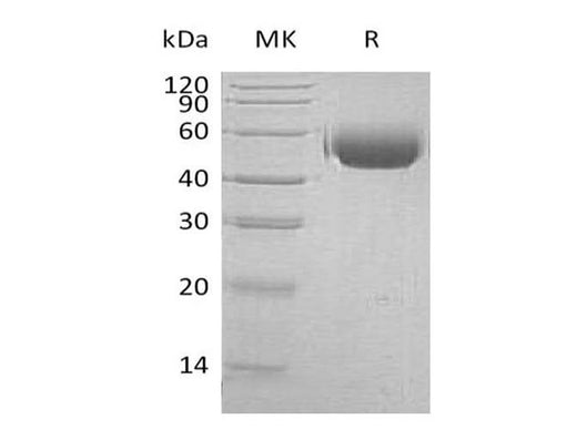Recombinant Human CD172a/SIRPA Protein (His Tag) - ABMIUM