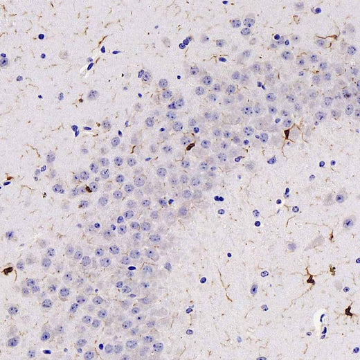 Immunohistochemistry analysis of paraffin-embedded mouse brain using AIF1 Polyclonal Antibody at dilution of 1:300.