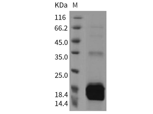 Recombinant Mouse S100A9 Protein (His Tag) - ABMIUM