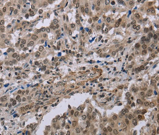 Anti-Human MGLL Antibody - ABMIUM