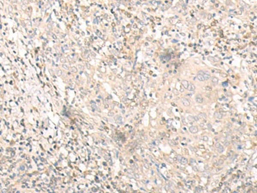 Anti-Human IL24 Antibody