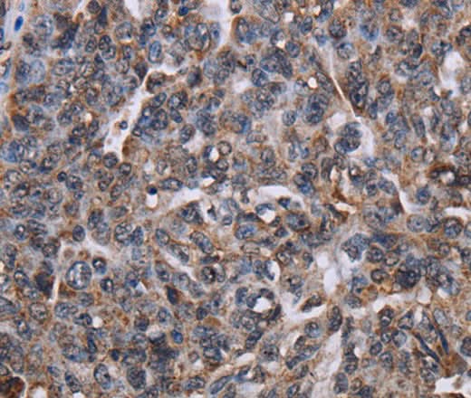 Anti-Human LDOC1 Antibody - ABMIUM