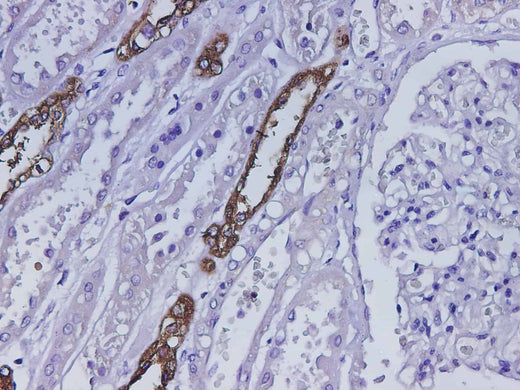 Anti-Human UMOD Antibody - ABMIUM