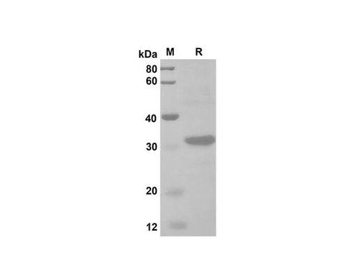 SDS-PAGE analysis of Human CCL23/MPIF-1 proteins, 2 μg/lane of Recombinant Human CCL23/MPIF-1 proteins was resolved with SDS-PAGE under reducing conditions, showing bands at 31 kDa.