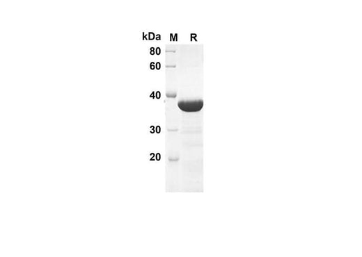 SDS-PAGE analysis of Mouse SHH proteins, 2 μg/lane of Recombinant Mouse SHH proteins was resolved with an SDS-PAGE under reducing conditions, showing bands at 39.1 kDa.