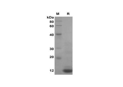 SDS-PAGE analysis of Rat IL-2 proteins, 2 μg/lane of Recombinant Rat IL-2 proteins was resolved with SDS-PAGE under reducing conditions, showing bands at 14 kDa.