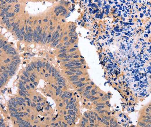Anti-Human/Mouse/Rat NR3C1 Antibody