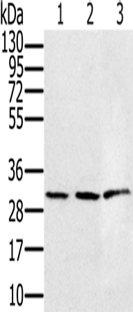 Anti-Human/Mouse/Rat HSD17B8 Antibody - ABMIUM