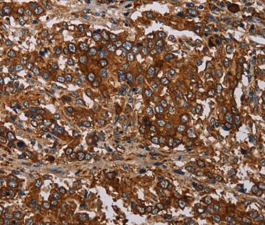 Anti-Human MAGEC2 Antibody - ABMIUM