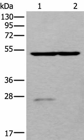 Western blot analysis of Human left kidney tissue and Human fetal liver tissue lysates using DDC Polyclonal Antibody at dilution of 1:800